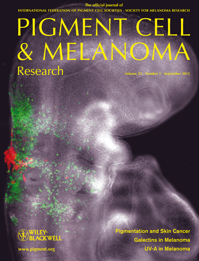 Pigment Cell & Melanoma Research 25:5 (September 2012 issue)